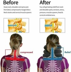 🔥🔥🔥Cervical Neck Traction Device Inflatable & Adjustable Neck Stretcher Neck