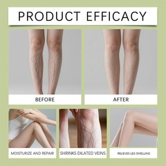 Vein Repair Microneedle Patch Roll, Vein Repair Patches, Professional Treatment