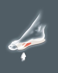 Pedag Galant 144 arch support, forefoot metatarsal pads splayfoot care for women