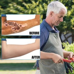 2 Pairs Elderly Skin Protection Sleeves Arm Protector for Thin Skin Bruising …