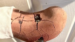 Vintage Ottobock Titan Left – Above the knee with Original Stub