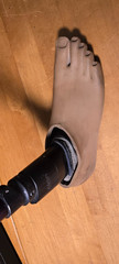 Elan Trulife Prosthetic Leg Carbon Fiber Below Knee 160kg Max