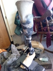CARBON FIBER BELOW-KNEE PROSTHETIC LEG META METACORE FOOT APC TRULIFE LEFT FOOT