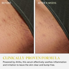 Fur Ingrown Eliminator Serum Rollerball Travel Size – Ingrown Hair Treatment