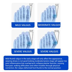 Bunion Fix Toe Valgus Corrector Adjustable Orthosis Women Men Splints