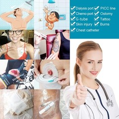 Waterproof Stretch Adhesive Bandage PD Dialysis 6 x 6 Inch (Pack of 50)