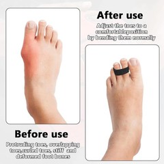 4Pcs Black Buddy Tape Finger Straps, Hook and Loop Splint for Finger Buddy St…