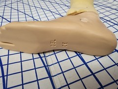 Complete Prosthetic Left Leg Knee WillowWood Limblogic Trulife Adult Dallas Cowb