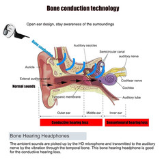 Bone Conduction Hearing Aids Hearing Wireless Open Ear Bluetooth 5.3 Earphones
