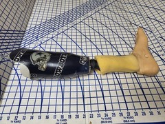 Complete Prosthetic Left Leg Knee WillowWood Limblogic Trulife Adult Dallas Cowb
