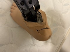 Ottobock Bulldog/Trulife/Soleus Prosthetic Leg Below Knee Left, SEE DESCRIPTION