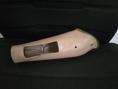 Lot of Five (5) Left Below Elbow Prosthetic Arms – Myoelectric & Body-Powered