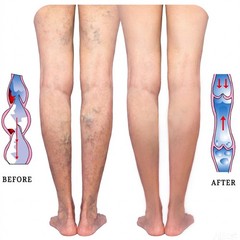 LIN PERFORMANCE 15-20 mmHg Compression Socks X-Large, Beige/15-20mmhg/1pair