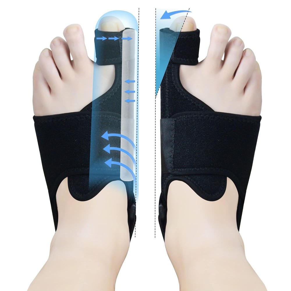 MOONSMILE 1 Pair Foot Bunion Corrector for Women & Men, Night Bunion Splint, …