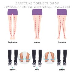 2 Pairs 3 Layers Medial & Lateral Heel Wedge Silicone Large, Multicolor