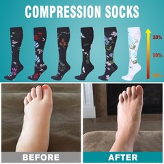 20-30 mmH Compression Socks for Women&Men Circulation Best Support for Athletic