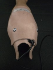 Vintage Right Children’s Below Elbow Myoelectric Prosthetic Arm, Wired, Works
