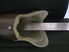 Lot of Three (3) Right Below Elbow Prosthetic Arms – Myoelectric, Parts, Collect