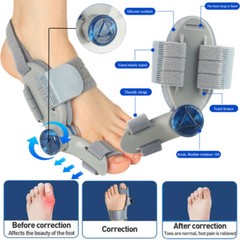 Treatment Bunion Fix ,Toe Valgus Corrector Adjustable Orthosis Women Men Splints