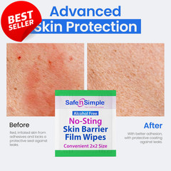 No Sting Skin Barrier Wipes 100 Ct Alcohol Free Ostomy Stoma Skin Prep – US