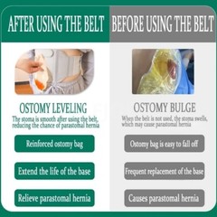 Ostomy Support Belt Adjustable Stoma Support Belt Ileostomy Colostomy Belt