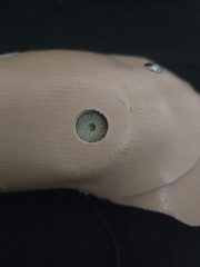 Vintage Right Children’s Below Elbow Myoelectric Prosthetic Arm, Wired, Works