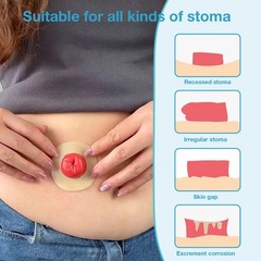 TNTNDAY 10PCS Ostomy Barrier Rings 4mm Thickness Moldable Leak-Proof Skin Rings