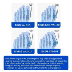 Bunion Fix Toe Valgus Corrector Adjustable Orthosis Women Men Splints