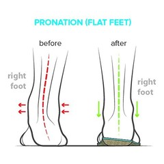Footscientific Arches Type 1 Flat Feet Orthotic Shoe Insoles Mens Size 14-14.5
