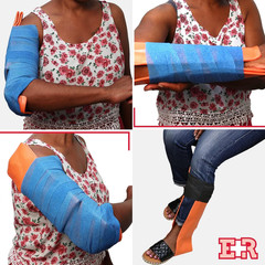 Universal Aluminum Splint, 36 Inch Rolled, 5 Ounce