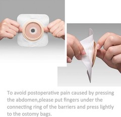 Carbou 21 PCS Ostomy Supplies Colostomy Bags Two Piece Ostomy Bag with Closure 1