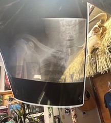 X-rays lot of 10 shoulder /ribs / Legs