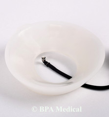 Small Vacuum Bell for Pectus Excavatum ( 190 mm – 7.5″ )