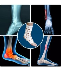 Ankle stabilizer for Foot Fractures, Ankle Sprains, Fractures or Achilles Tendon
