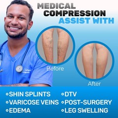 Compression Pantyhose for Women 20-30mmHg – Varicose Veins and Swelling – A204