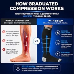 SB SOX 3-Pair Compression Socks for Men & Women (15-20mmHg) – Best Compressio…