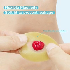 TNTNDAY 10PCS Ostomy Barrier Rings 4mm Thickness Moldable Leak-Proof Skin Rings