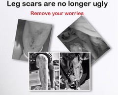 Highly Simulated Skin Artificial Silicone Prosthesis Foot Sleeve Leg Cover Scars