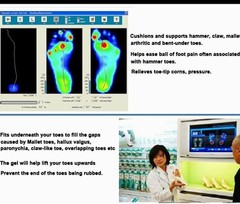 2 Silicone Gel Orthopedic Metatarsal Rings Help Correct Hammer Toe Seperator