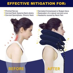 Adjustable Neck Stretcher & Cervical Traction Device for Pain Relief – Home Use