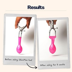 GlanMax Phimosis Stretching Tool – Adjustable to 24mm for Safe, Quick Relief