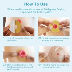 TNTNDAY 10PCS Ostomy Barrier Rings 4mm Thickness Moldable Leak-Proof Skin Rings