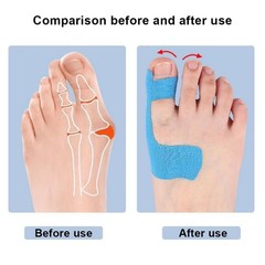 10PCS Bunion Corrector Kinesiology Tape Pain Relief Big Toe Spacer Support New