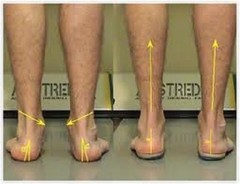 3 Pair Custom Orthotics Custom Arch Supports for Feet Ankles Knees Back and Neck