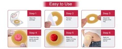 Hollister 7805 Adapt 2” Flat Barrier Rings, 10 Pack – Ostomy Barrier Ring