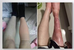 Highly Simulated Skin Artificial Silicone Prosthesis Foot Sleeve Leg Cover Scars