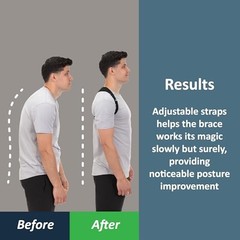 ComfyBrace Posture Corrector Back Brace for Men & Women – Adjustable Spine