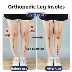 Orthopedic Pair 1 Insole for OX Leg Correction Gel Massage Support Shoe Pad