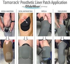 GlideWear Prosthetic Liner Patch for Amputees (2 Pack)