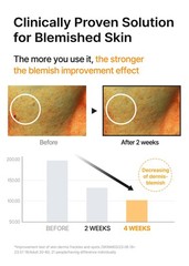 celimax Pore+Dark Spot Brightening Serum 30ml | Gel-like Serum for Enlarged Pore